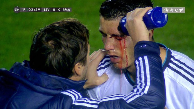 关于C罗在皇家马德里比赛中绝杀，连败引发热议！的信息-官方网站